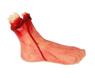 Utržená noha